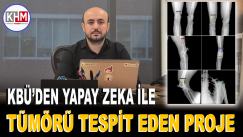 Karabük Üniversitesi’nden yapay zeka ile kemik dokusu üzerindeki tümörü tespit eden proje